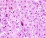 apoptoza  - zapalenie wirusowe (wtroba)